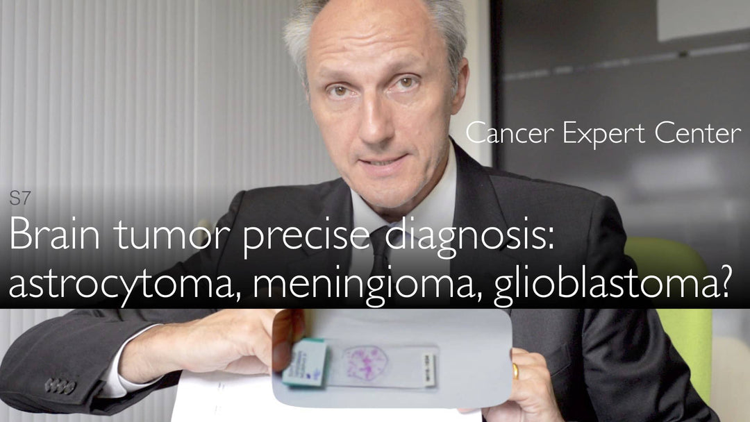 Nøjagtig diagnostik af hjertetumorer. Meningeom, astrocytom, glioblastom. 6