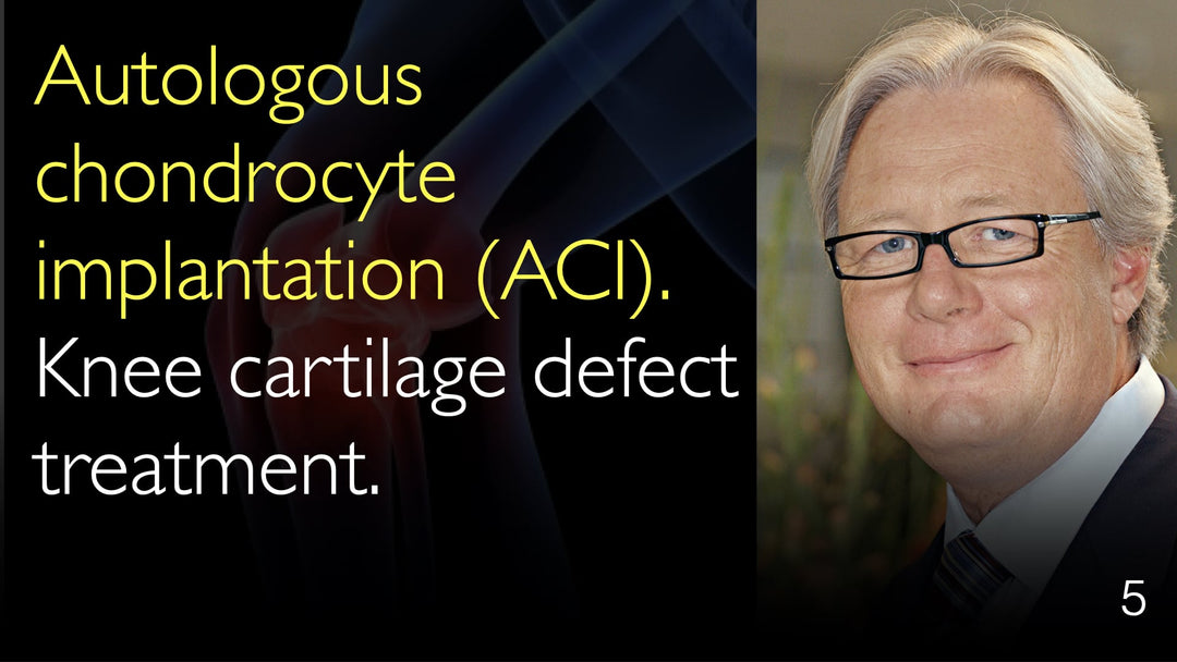 Autolog chondrocyttransplantation (ACT). Behandling af knæbruskelskader. 5