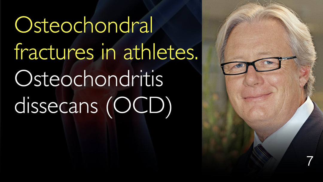Osteokondrale frakturer hos atleter. OCD (Osteochondritis dissecans). 7