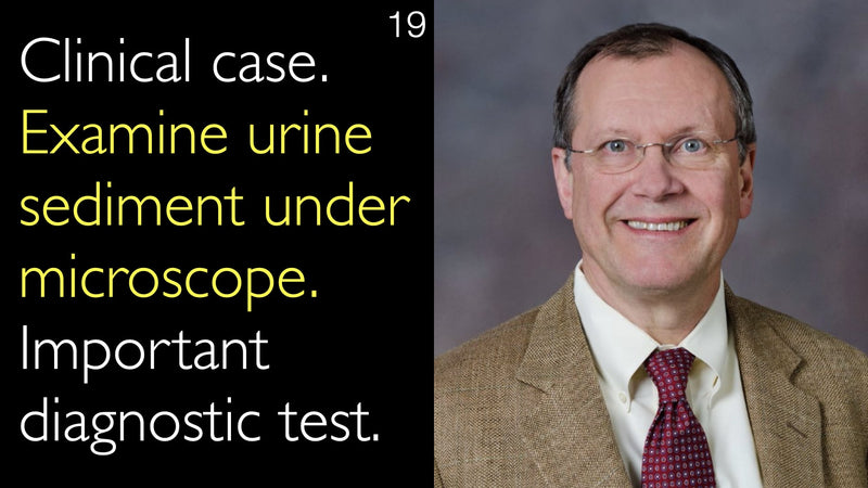Clinical case. Examine urine sediment under microscope. Important diagnostic test. 19
